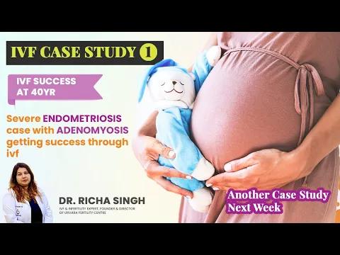 IVF Success after 17 years of struggle in endometriosis