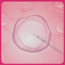 भारत में IVF के लिए सही उम्र क्या है?