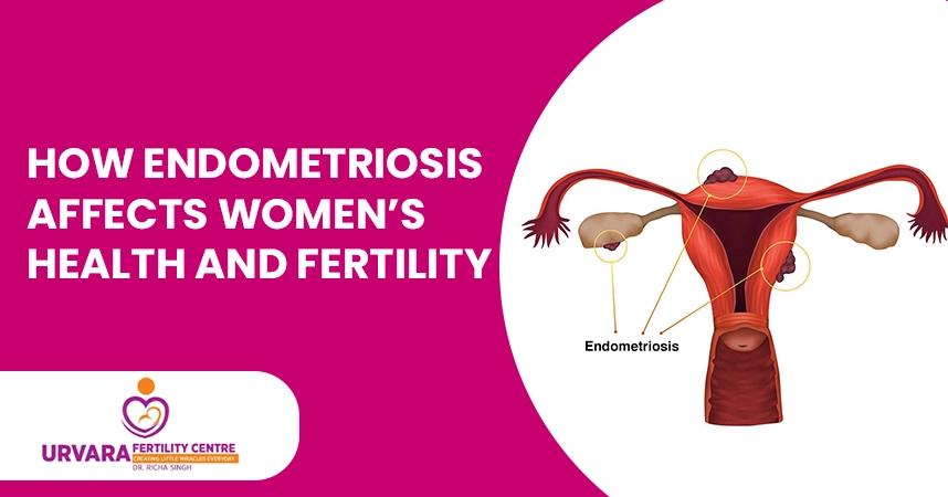 How Endometriosis Affects Women’s Health and Fertility