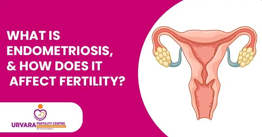 What is Endometriosis, and How Does it Affect Fertility?
