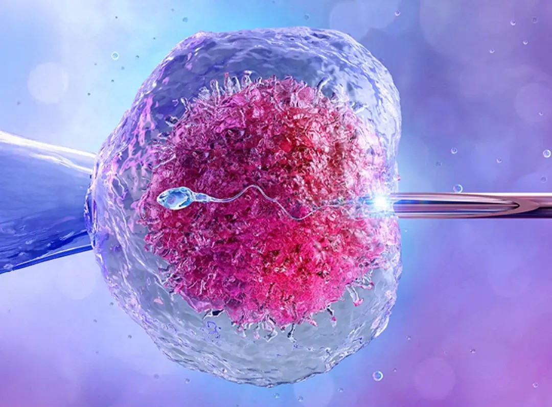 In vitro fertilization (IVF)