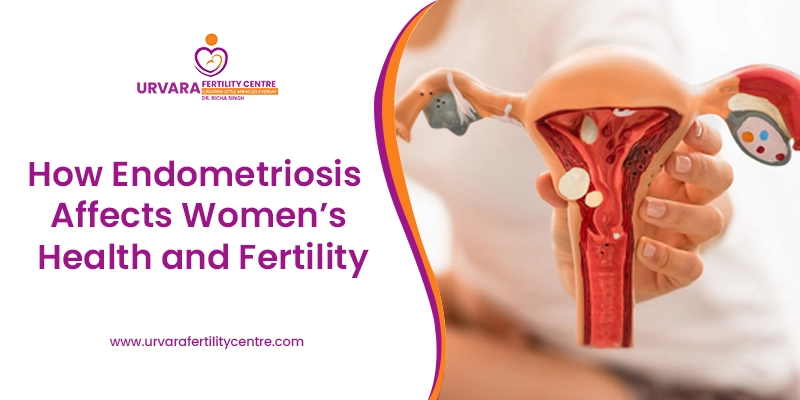 How Endometriosis Affects Women’s Health and Fertility